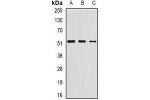 Western blot analysis of AMCase expression in HepG2 (A), mouse stomach (B), rat lung (C) whole cell lysates. (CHIA antibody)