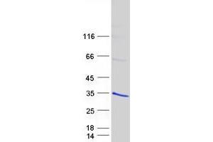 Validation with Western Blot (RGS19 Protein (Transcript Variant 2) (Myc-DYKDDDDK Tag))