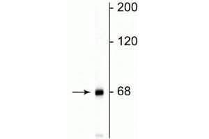 Western blot of rat cortical lysate showing specific immunolabeling of the ~68 kDa NF-L protein. (NEFL antibody)