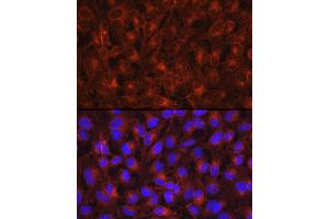Immunofluorescence analysis of HeLa cells using Axl Rabbit pAb (ABIN7265804) at dilution of 1:200 (40x lens). (AXL antibody)