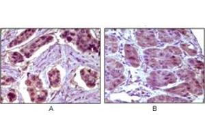 Immunohistochemistry (IHC) image for anti-B-Cell CLL/lymphoma 10 (BCL10) antibody (ABIN1105500) (BCL10 antibody)