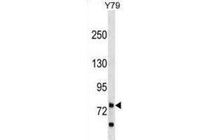 Western Blotting (WB) image for anti-Rhophilin, rho GTPase Binding Protein 1 (RHPN1) antibody (ABIN3000053)