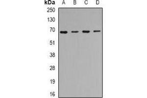 Western blot analysis of CIP4 expression in Hela (A), SKOV3 (B), mouse kidney (C), mouse heart (D) whole cell lysates. (TRIP10 antibody)