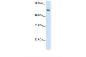 Image no. 1 for anti-Argininosuccinate Lyase (ASL) (AA 260-309) antibody (ABIN320665) (ASL antibody  (AA 260-309))