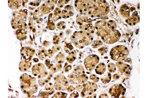 Immunohistochemistry (Paraffin-embedded Sections) (IHC (p)) image for anti-Parkinson Protein 7 (PARK7) (AA 2-189) antibody (ABIN3043589) (PARK7/DJ1 antibody  (AA 2-189))