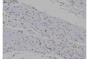 ABIN6263351 and ABIN6277272 at 1/100 staining Human gastric tissue by IHC-P.