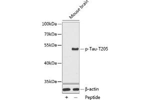 Western blot analysis of extracts from mouse brain tissue, using phospho-Tau-T205 antibody (ABIN3019697, ABIN3019698, ABIN3019699 and ABIN7101862). (MAPT antibody  (pThr205))