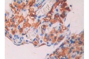 Detection of CA7 in Mouse Ovary Tissue using Polyclonal Antibody to Carbonic Anhydrase VII (CA7) (CA7 antibody  (AA 58-217))