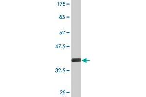 Western Blot detection against Immunogen (35. (ADAM20 antibody  (AA 268-358))