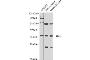 Western blot analysis of extracts of various cell lines, using OGN antibody (ABIN6131952, ABIN6145008, ABIN6145009 and ABIN6222384) at 1:1000 dilution. (OGN antibody  (AA 20-298))