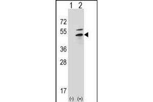 Western blot analysis of PRKAR2B (arrow) using rabbit polyclonal PRKAR2B Antibody (G46) (ABIN391062 and ABIN2841217). (PRKAR2B antibody  (N-Term))