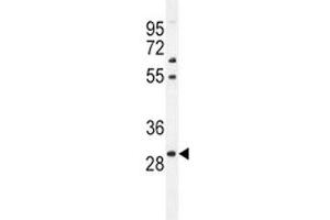 PHOX2B antibody  (AA 104-130)