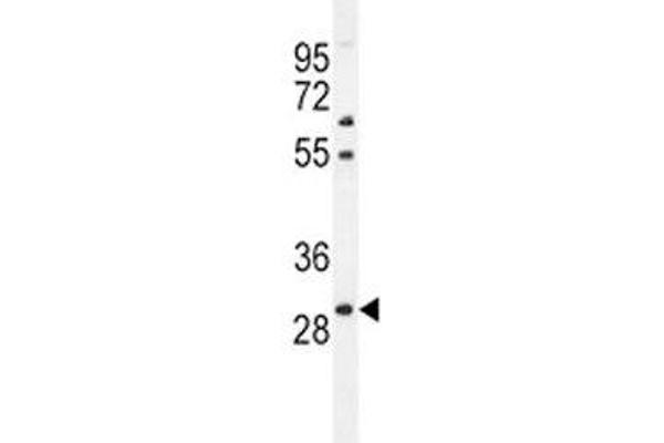 PHOX2B antibody  (AA 104-130)