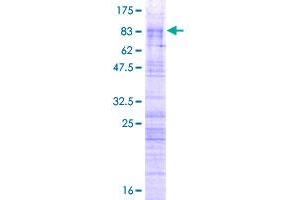 ZRSR2 Protein (AA 1-482) (GST tag)