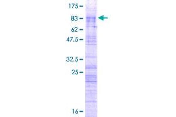 ZRSR2 Protein (AA 1-482) (GST tag)