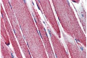 Skeletal muscle, Human: Formalin-Fixed, Paraffin-Embedded (FFPE) (SOD2 antibody)