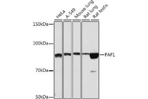 Western blot analysis of extracts of various cell lines, using P Rabbit mAb (ABIN7269152) at 1:1000 dilution. (PAF1/PD2 antibody)