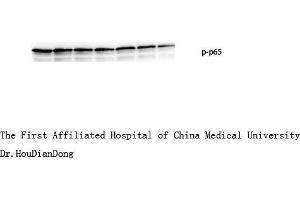 Western Blot (WB) analysis: Please contact us for more details. (NF-kB p65 antibody  (pSer276))