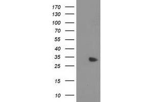 Western Blotting (WB) image for anti-Myeloid Differentiation Primary Response Gene (88) (MYD88) antibody (ABIN1499612) (MYD88 antibody)