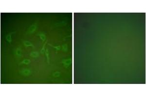 Immunofluorescence analysis of HepG2 cells, using Mammaglobin Antibody.