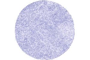 PAX8 staining is completely absent in lymphocytes lymph node (Recombinant PAX8 antibody)