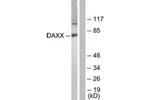 Western blot analysis of extracts from COS7 cells, treated with Serum 10% 30', using Daxx (Ab-668) Antibody. (DAXX antibody  (AA 634-683))