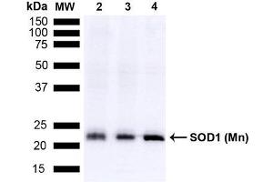 Western blot analysis of Mouse Brain, Rat Brain, and Rat Brain Membrane showing detection of 24. (SOD2 antibody  (Biotin))