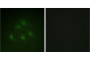 Immunofluorescence analysis of HeLa cells, using Smad1 (Ab-187) Antibody. (SMAD1 antibody  (AA 153-202))