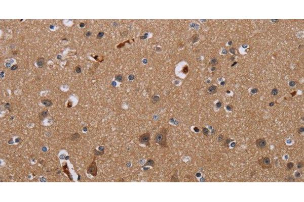 KLHL1 antibody