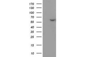 HEK293T cells were transfected with the pCMV6-ENTRY control (Left lane) or pCMV6-ENTRY DTNA (Right lane) cDNA for 48 hrs and lysed. (DTNA antibody)