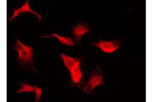 Immunofluorescence (fixed cells) (IF/ICC) image for anti-Structural Maintenance of Chromosomes 1A (SMC1A) (pSer957) antibody (ABIN6255569)