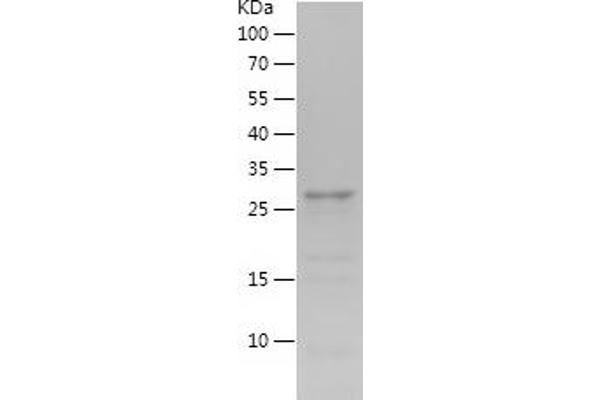 OXM Protein (AA 53-89) (His-IF2DI Tag)