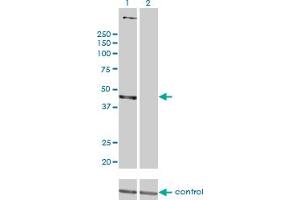 Western blot analysis of PSMD6 over-expressed 293 cell line, cotransfected with PSMD6 Validated Chimera RNAi (Lane 2) or non-transfected control (Lane 1).