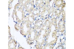 Immunohistochemistry of paraffin-embedded Human stomach using AHCYL1 Polyclonal Antibody at dilution of 1:100 (40x lens). (AHCYL1 antibody)