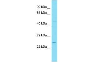 Host: Rabbit Target Name: WFDC3 Sample Type: 721_B Whole Cell lysates Antibody Dilution: 1. (WFDC3 antibody  (N-Term))