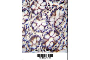 IQCA1 Antibody immunohistochemistry analysis in formalin fixed and paraffin embedded human rectum tissue followed by peroxidase conjugation of the secondary antibody and DAB staining. (IQCA1 antibody  (C-Term))