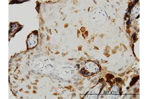 Immunohistochemistry (Formalin-fixed Paraffin-embedded Sections) (IHC (fp)) image for anti-Metalloproteinase Inhibitor 2 (TIMP2) (AA 27-220) antibody (ABIN948562)