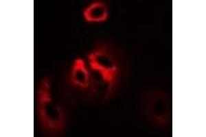 Immunofluorescent analysis of RPS7 staining in SW480 cells. (RPS7 antibody)