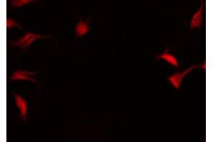 Immunofluorescence (fixed cells) (IF/ICC) image for anti-Nuclear Factor of kappa Light Polypeptide Gene Enhancer in B-Cells 2 (NFKB2) (pSer872) antibody (ABIN6255544)