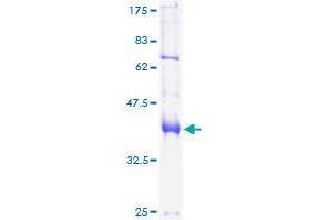 FOXP1 Protein (AA 1-114) (GST tag)