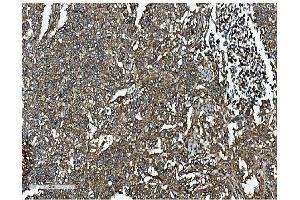 IHC analysis of Clathrin heavy chain/CLTC using anti-Clathrin heavy chain/CLTC antibody (ABIN7602704). (Clathrin Heavy Chain (CLTC) (AA 967-1668) antibody)