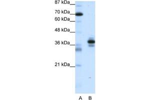 Western Blotting (WB) image for anti-Paired-Like Homeodomain 1 (PITX1) antibody (ABIN2461668)
