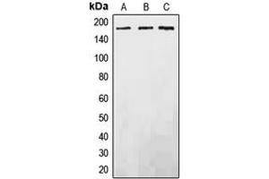 Western blot analysis of EGFR expression in DLD (A), SP2/0 (B), PC12 (C) whole cell lysates.