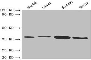 Western blot All lanes: BDH1 antibody at 2. (BDH1 antibody  (AA 47-343))