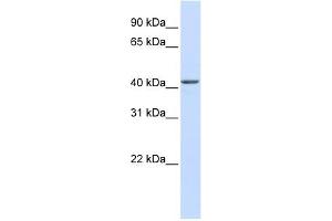 NOB1 antibody used at 1 ug/ml to detect target protein. (NOB1 antibody)