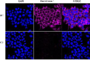 Immunocytochemical staining of HeLa cells using Hexokinase 1 antibody (ABIN7798906), 1:1,000), Top panel: wild-type (WT), Bottom panal: Hexokinase 1 shRNA knockdown (KD). (Recombinant Hexokinase 1 antibody)