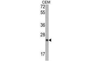 Western blot analysis of TIMP1 Antibody (N-term) in CEM cell line lysates (35ug/lane). (TIMP1 antibody  (N-Term))