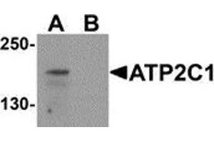 Western blot analysis of ATP2C1 in mouse brain tissue lysate with ATP2C1 antibody at 1 μg/ml in (A) the absence and (B) the presence of blocking peptide (ATP2C1 antibody  (C-Term))