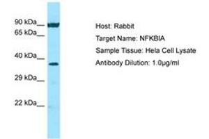 Image no. 1 for anti-Nuclear Factor of kappa Light Polypeptide Gene Enhancer in B-Cells Inhibitor, alpha (NFKBIA) (N-Term) antibody (ABIN6749808) (NFKBIA antibody  (N-Term))