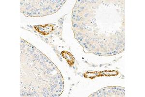 Immunohistochemistry of paraffin embedded rat testis using Desmuslin (ABIN7075800) at dilution of 1:500 (250x lens) (SYNM antibody)